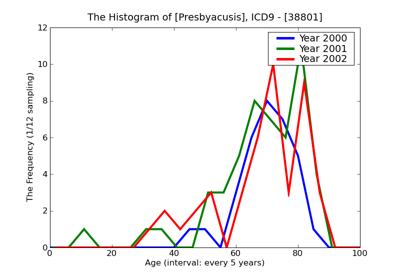 ICD9 Histogram Presbyacusis