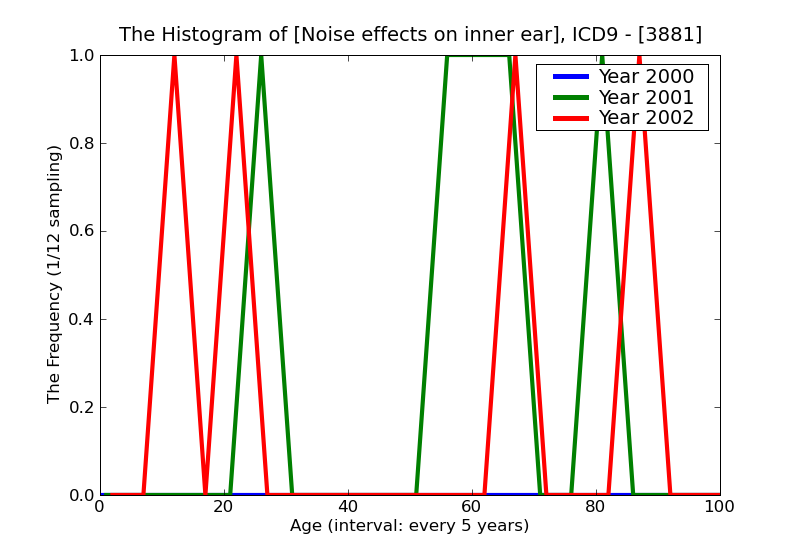 ICD9 Histogram Noise effects on inner ear