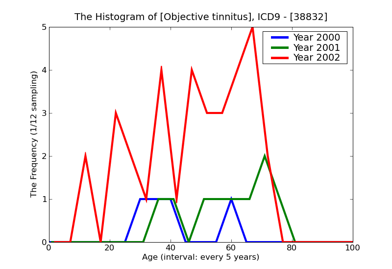 ICD9 Histogram Objective tinnitus