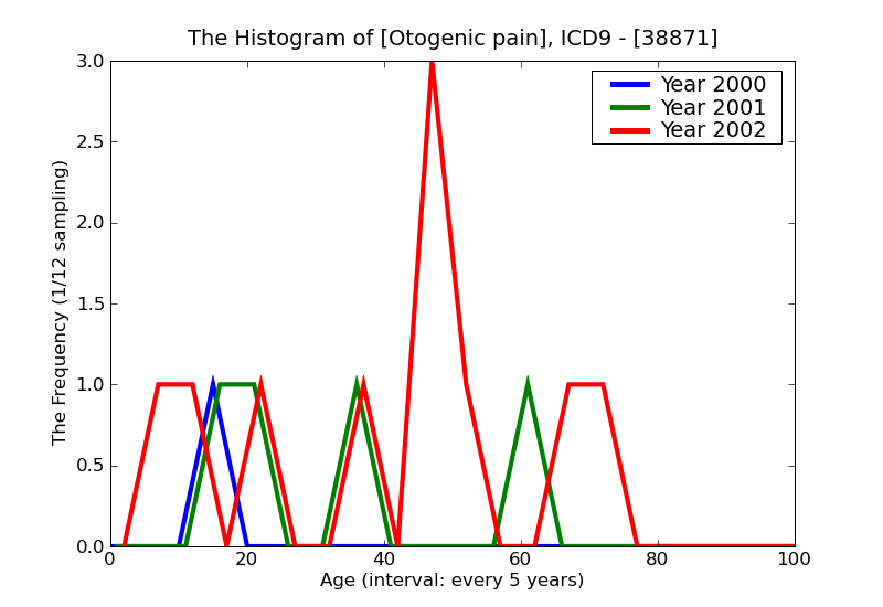ICD9 Histogram Otogenic pain
