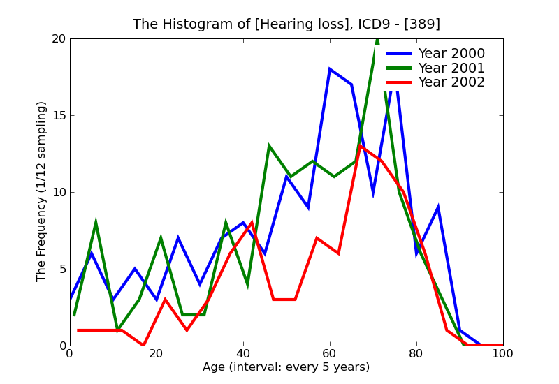 ICD9 Histogram Hearing loss
