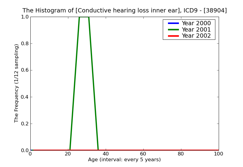 ICD9 Histogram Conductive hearing loss inner ear