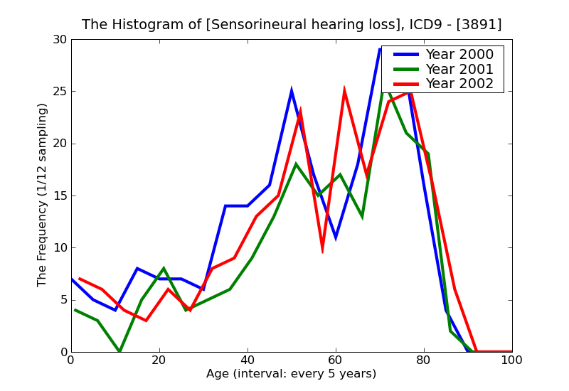 ICD9 Histogram Sensorineural hearing loss