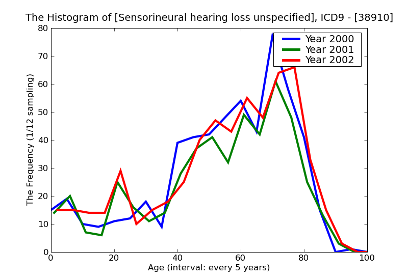 ICD9 Histogram Sensorineural hearing loss unspecified