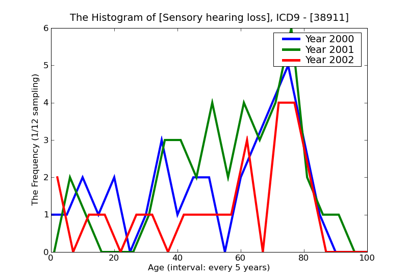 ICD9 Histogram Sensory hearing loss