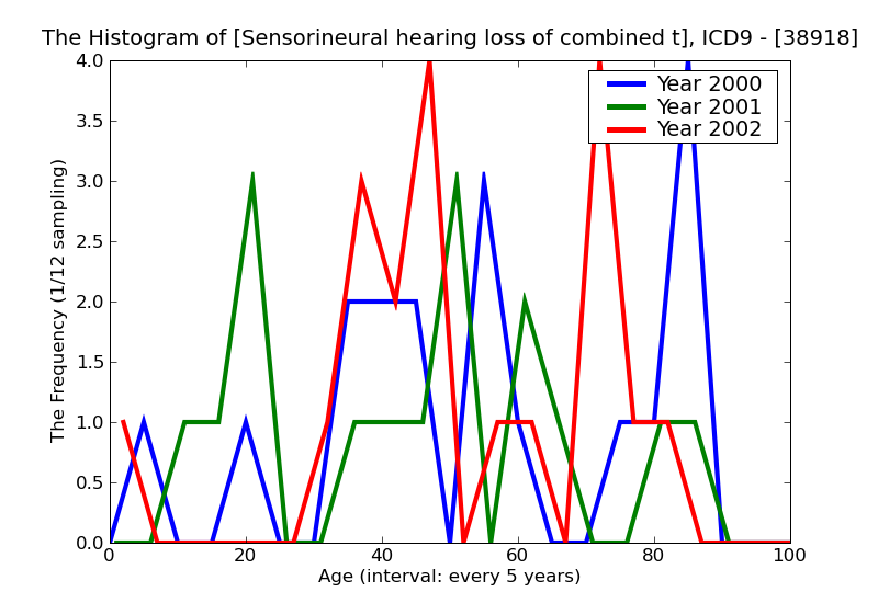 ICD9 Histogram Sensorineural hearing loss of combined types