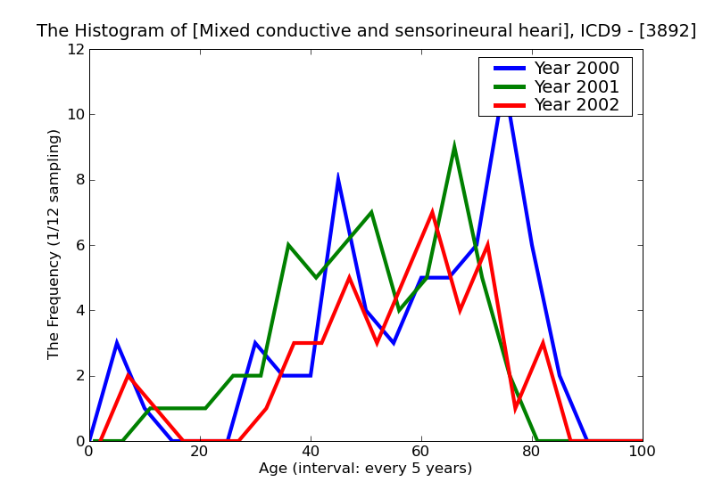 ICD9 Histogram Mixed conductive and sensorineural hearing loss
