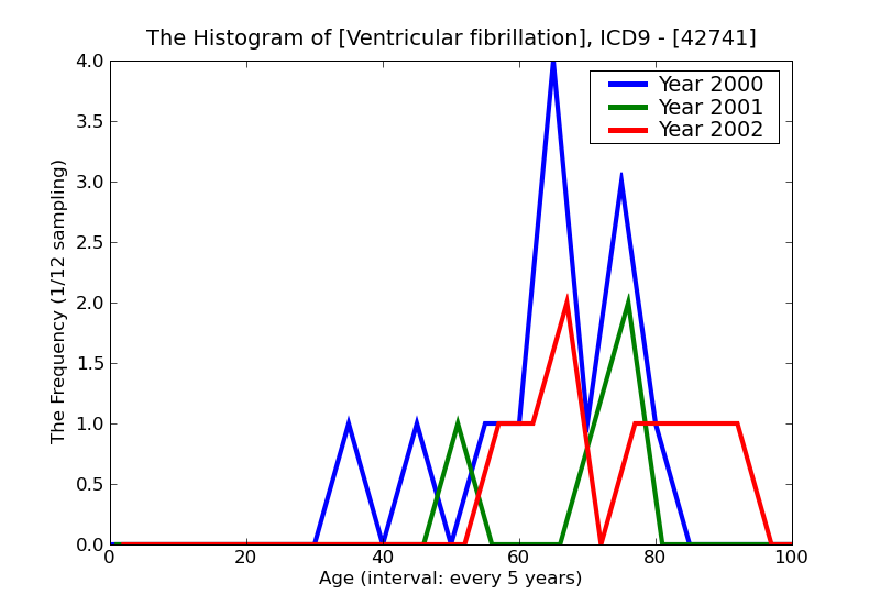 ICD9 Histogram Ventricular fibrillation
