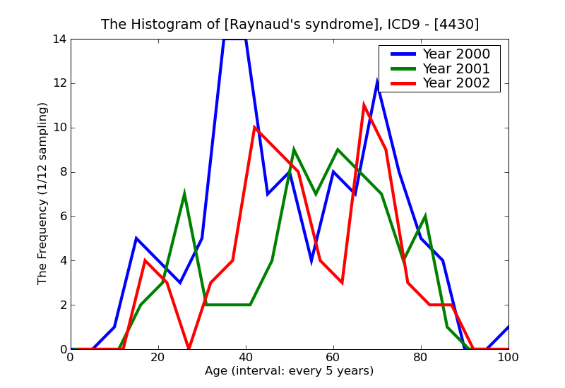 ICD9 Histogram Raynaud