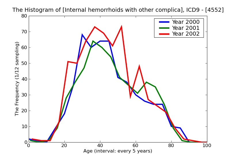 ICD9 Histogram Internal hemorrhoids with other complication