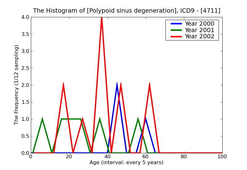 ICD9 Histogram Polypoid sinus degeneration