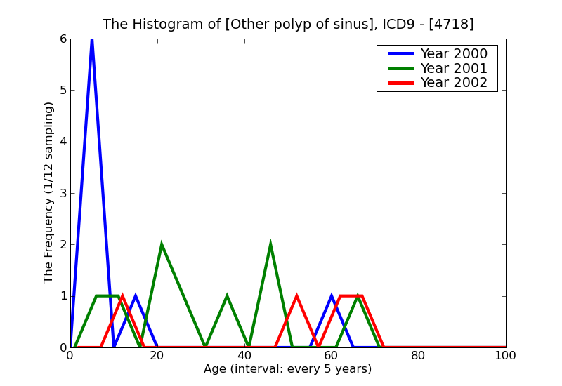 ICD9 Histogram Other polyp of sinus