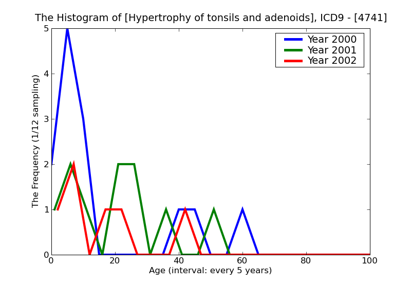 ICD9 Histogram Hypertrophy of tonsils and adenoids