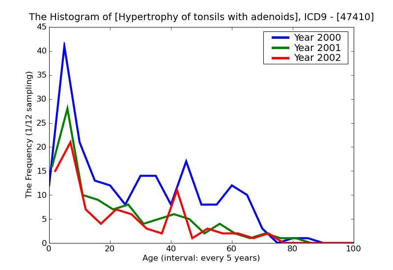 ICD9 Histogram Hypertrophy of tonsils with adenoids