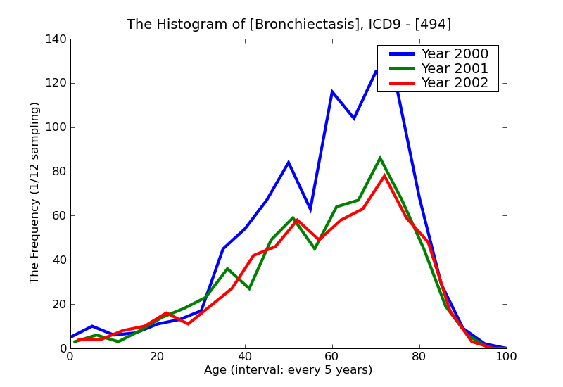 ICD9 Histogram Bronchiectasis
