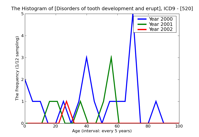 ICD9 Histogram Disorders of tooth development and eruption