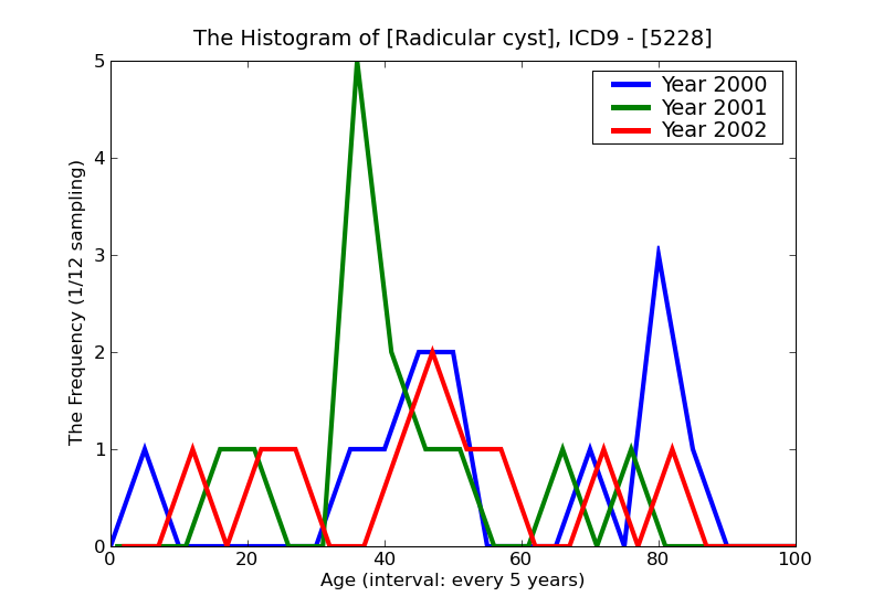 ICD9 Histogram Radicular cyst