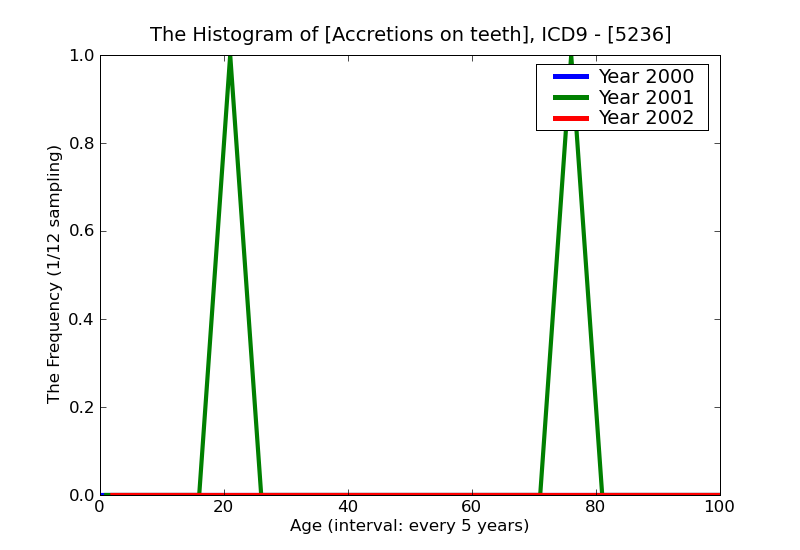 ICD9 Histogram Accretions on teeth