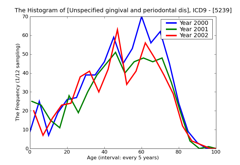 ICD9 Histogram Unspecified gingival and periodontal disease