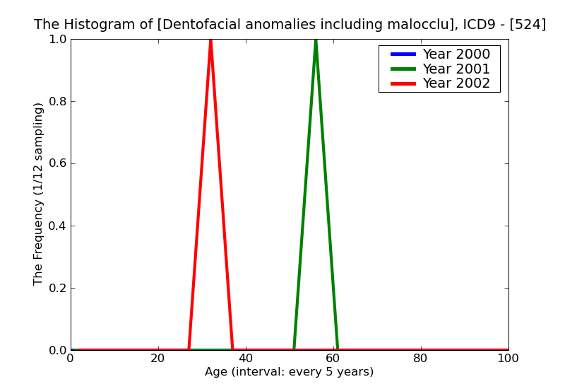 ICD9 Histogram Dentofacial anomalies including malocclusion