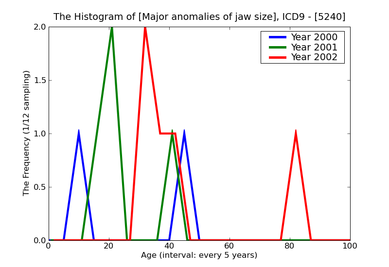 ICD9 Histogram Major anomalies of jaw size