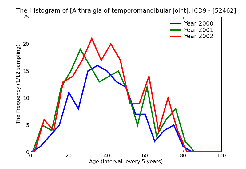 ICD9 Histogram Arthralgia of temporomandibular joint