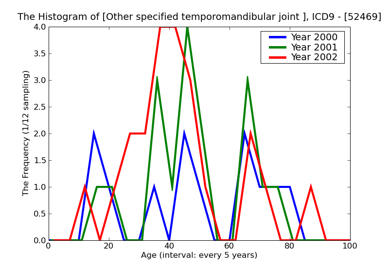 ICD9 Histogram Other specified temporomandibular joint disorders
