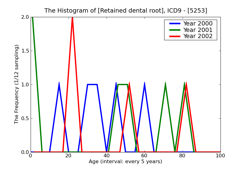 ICD9 Histogram Retained dental root