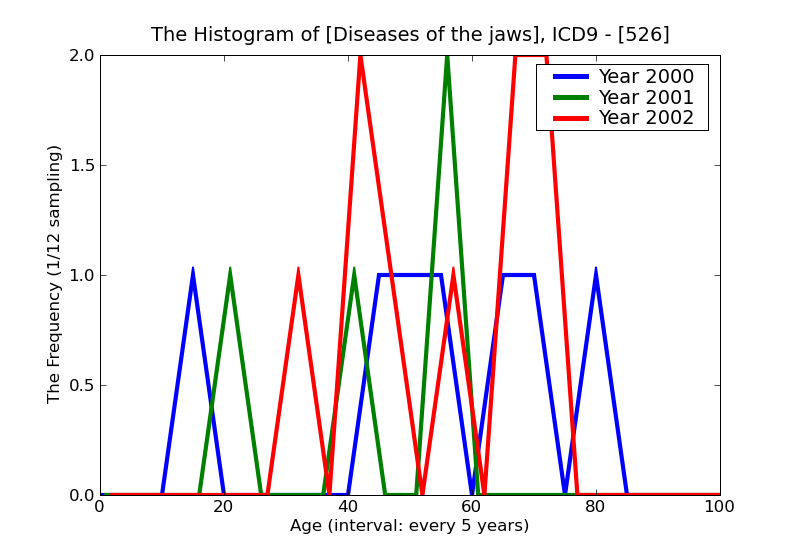 ICD9 Histogram Diseases of the jaws