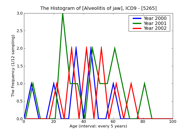 ICD9 Histogram Alveolitis of jaw