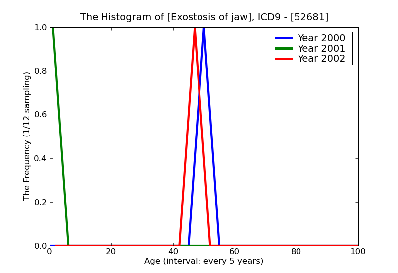 ICD9 Histogram Exostosis of jaw