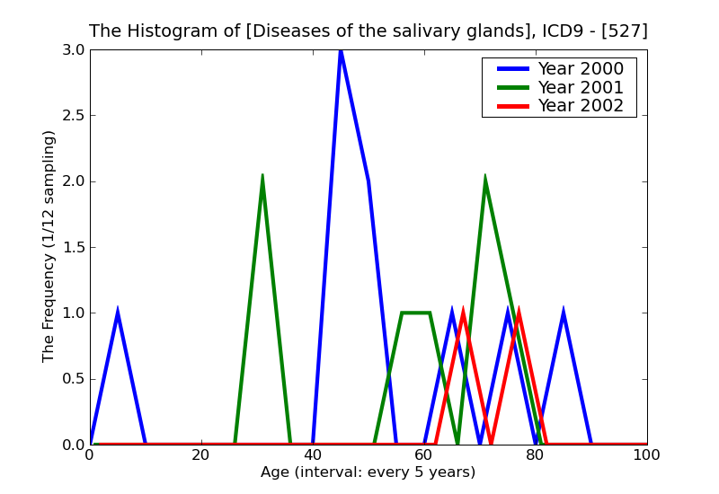 ICD9 Histogram Diseases of the salivary glands