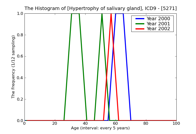 ICD9 Histogram Hypertrophy of salivary gland