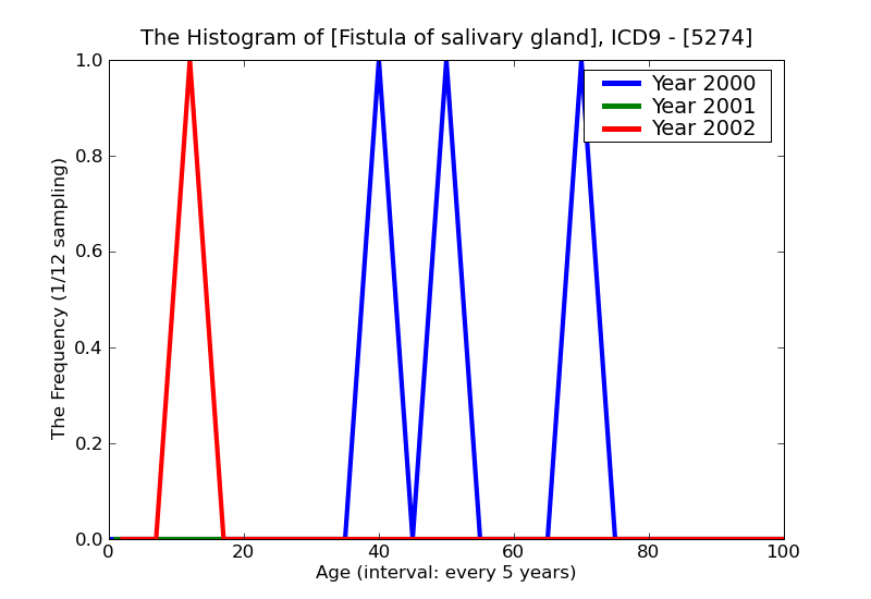 ICD9 Histogram Fistula of salivary gland