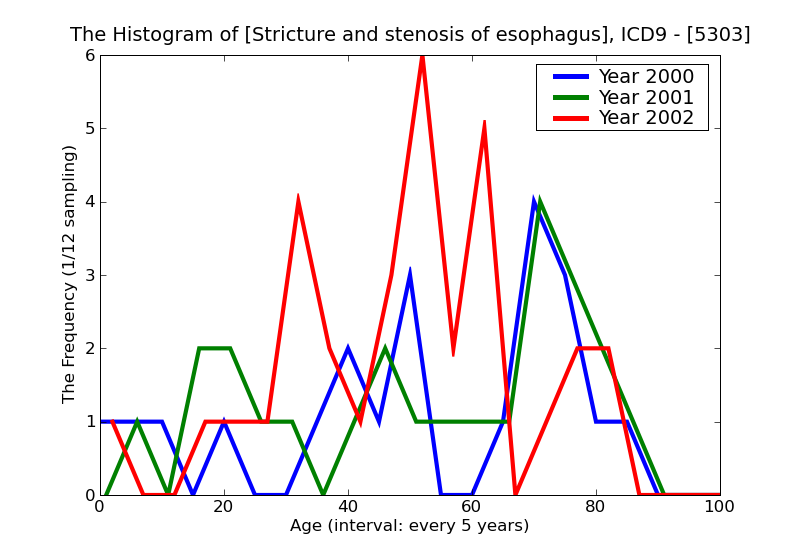 ICD9 Histogram Stricture and stenosis of esophagus
