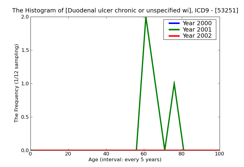 ICD9 Histogram Duodenal ulcer chronic or unspecified with perforation with obstruction