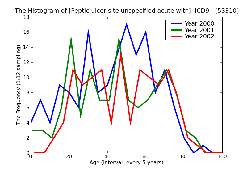 ICD9 Histogram Peptic ulcer site unspecified acute with perforation without mention of obstruction