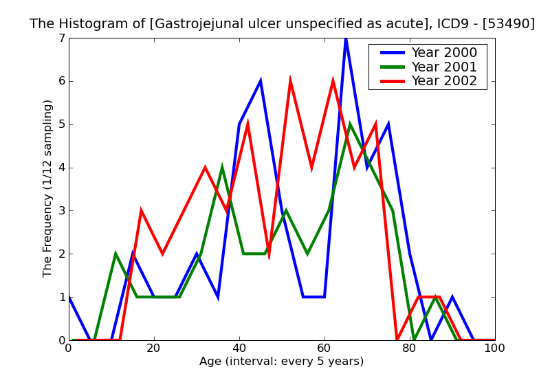 ICD9 Histogram Gastrojejunal ulcer unspecified as acute or chronic without mention of hemorrhage or  perforation wi