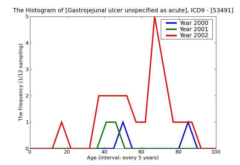 ICD9 Histogram Gastrojejunal ulcer unspecified as acute or chronic without mention of hemorrhage or perforation wit