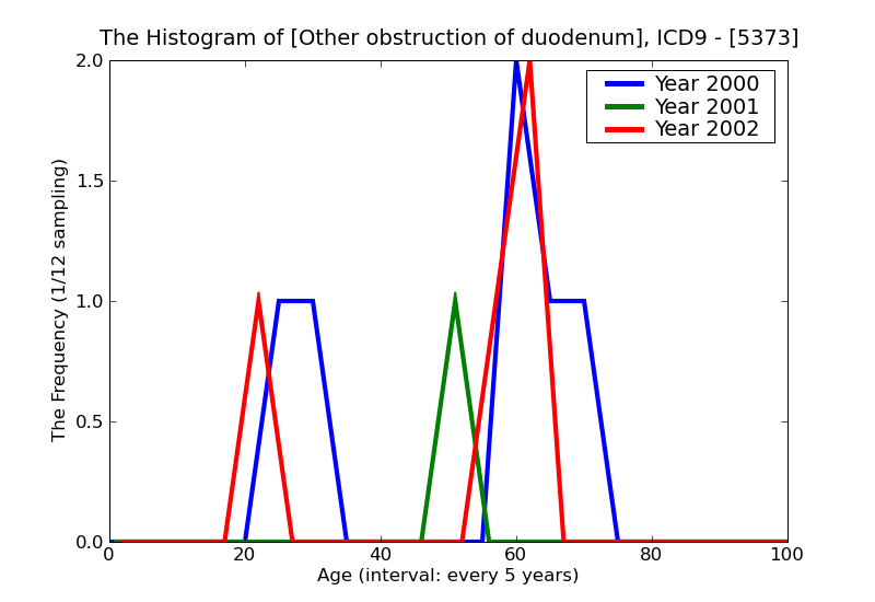 ICD9 Histogram Other obstruction of duodenum