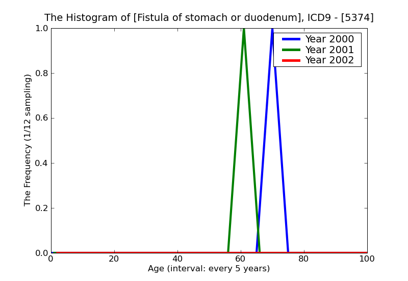 ICD9 Histogram Fistula of stomach or duodenum