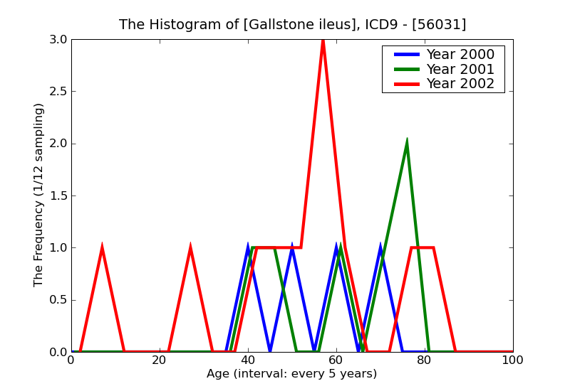 ICD9 Histogram Gallstone ileus