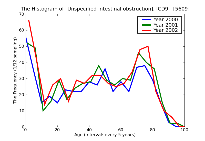 ICD9 Histogram Unspecified intestinal obstruction