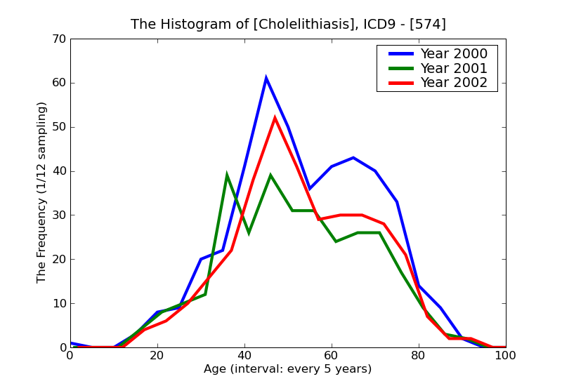 ICD9 Histogram Cholelithiasis