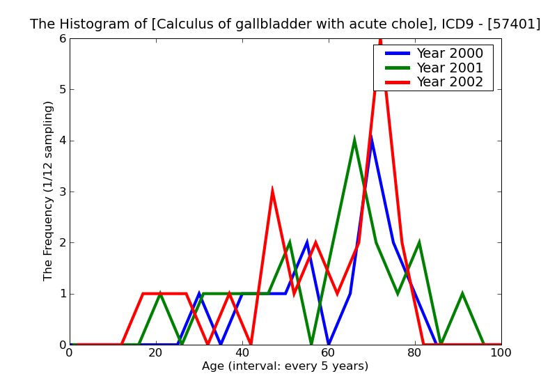 ICD9 Histogram Calculus of gallbladder with acute cholecystitis with obstruction