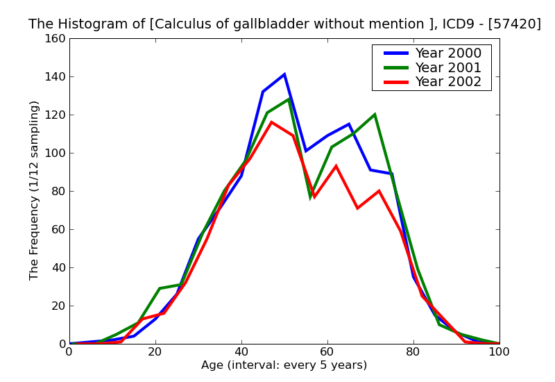 ICD9 Histogram Calculus of gallbladder without mention of cholecystitis and obstruction