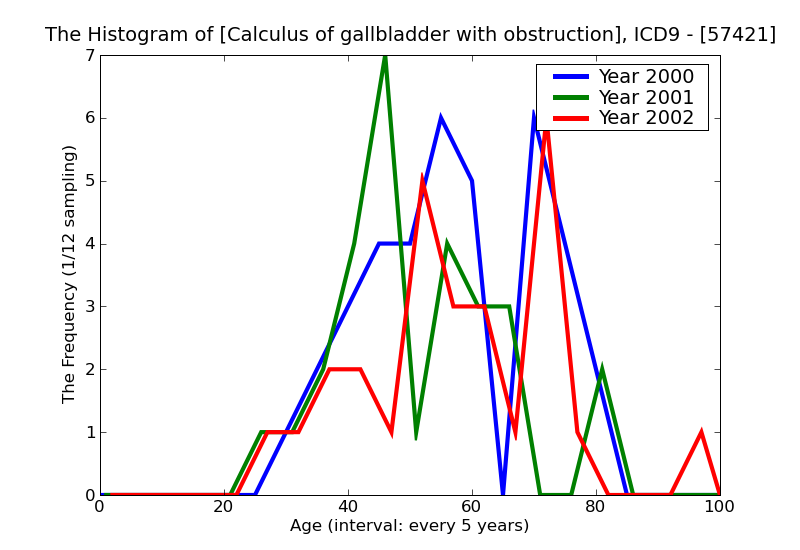 ICD9 Histogram Calculus of gallbladder with obstruction without mention of cholecystitis