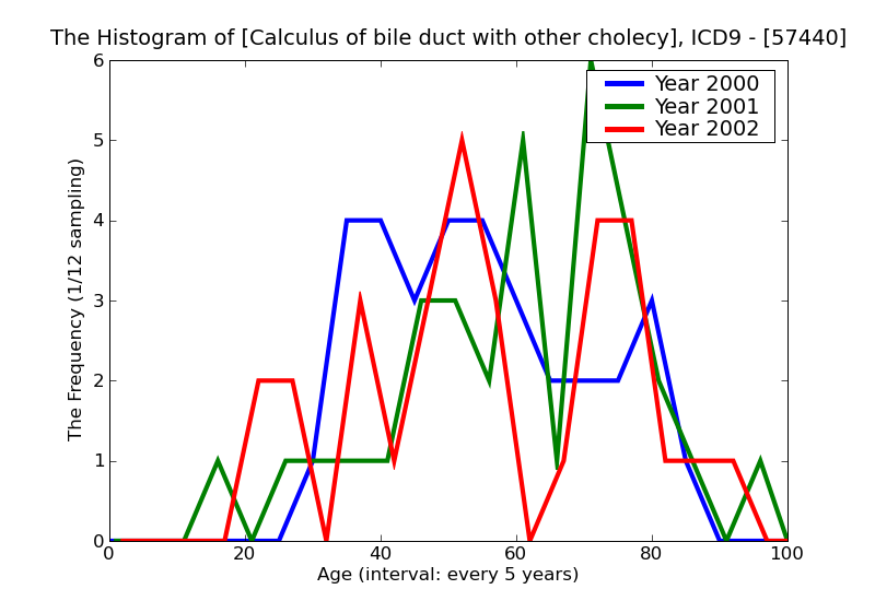 ICD9 Histogram Calculus of bile duct with other cholecystitis without mention of obstruction