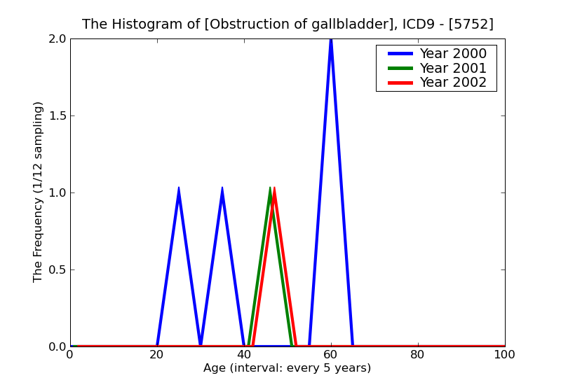 ICD9 Histogram Obstruction of gallbladder
