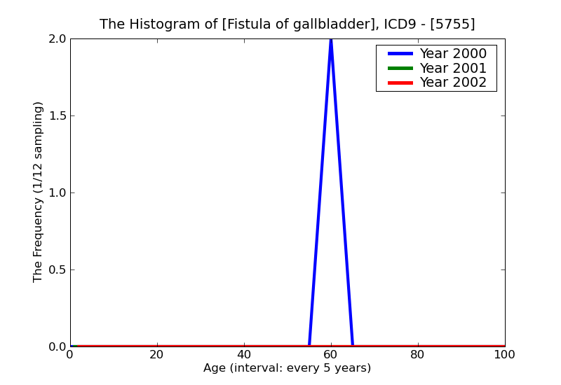 ICD9 Histogram Fistula of gallbladder
